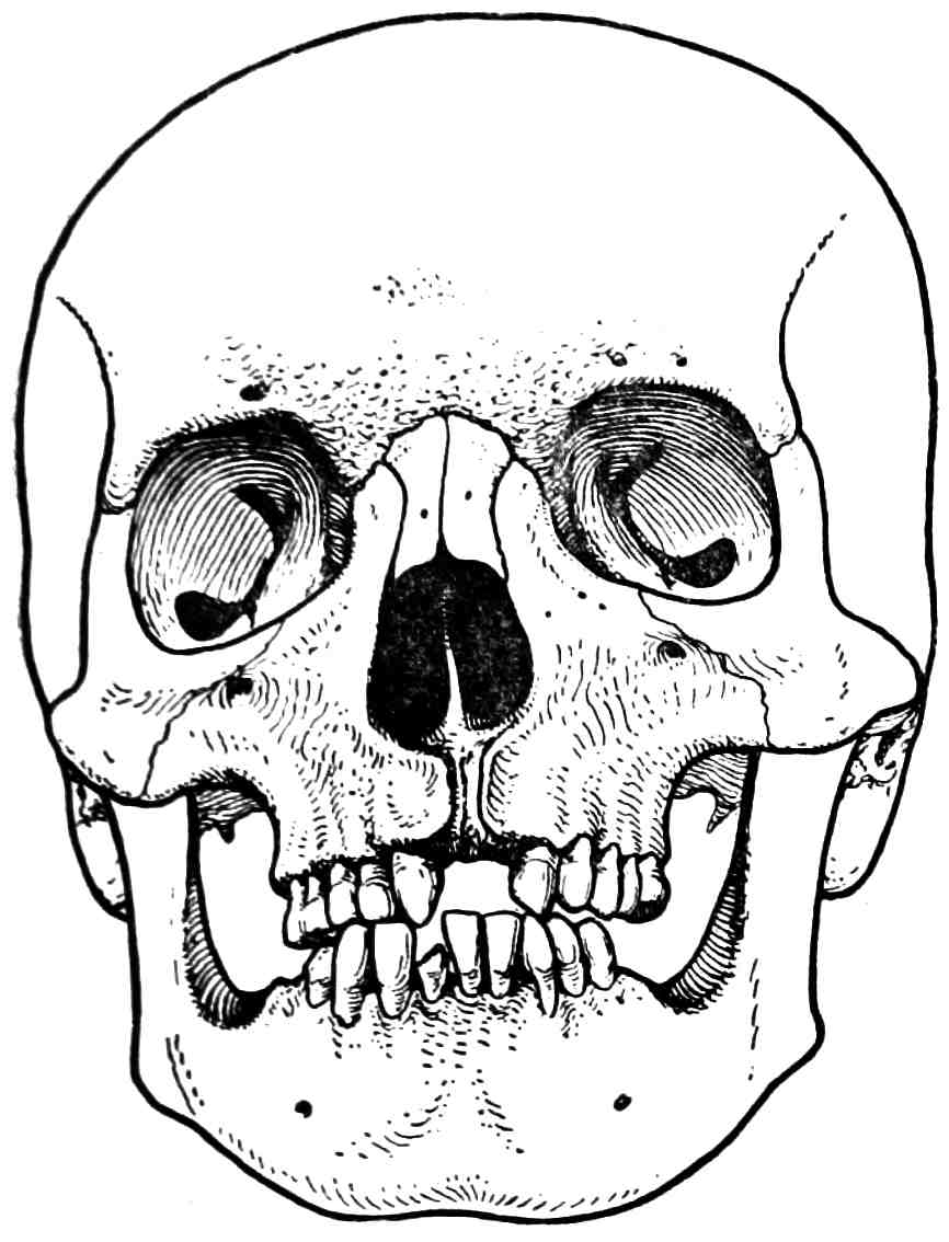Рис. 327. Отсутствие межчелюстных костей (Фишель, 1905).