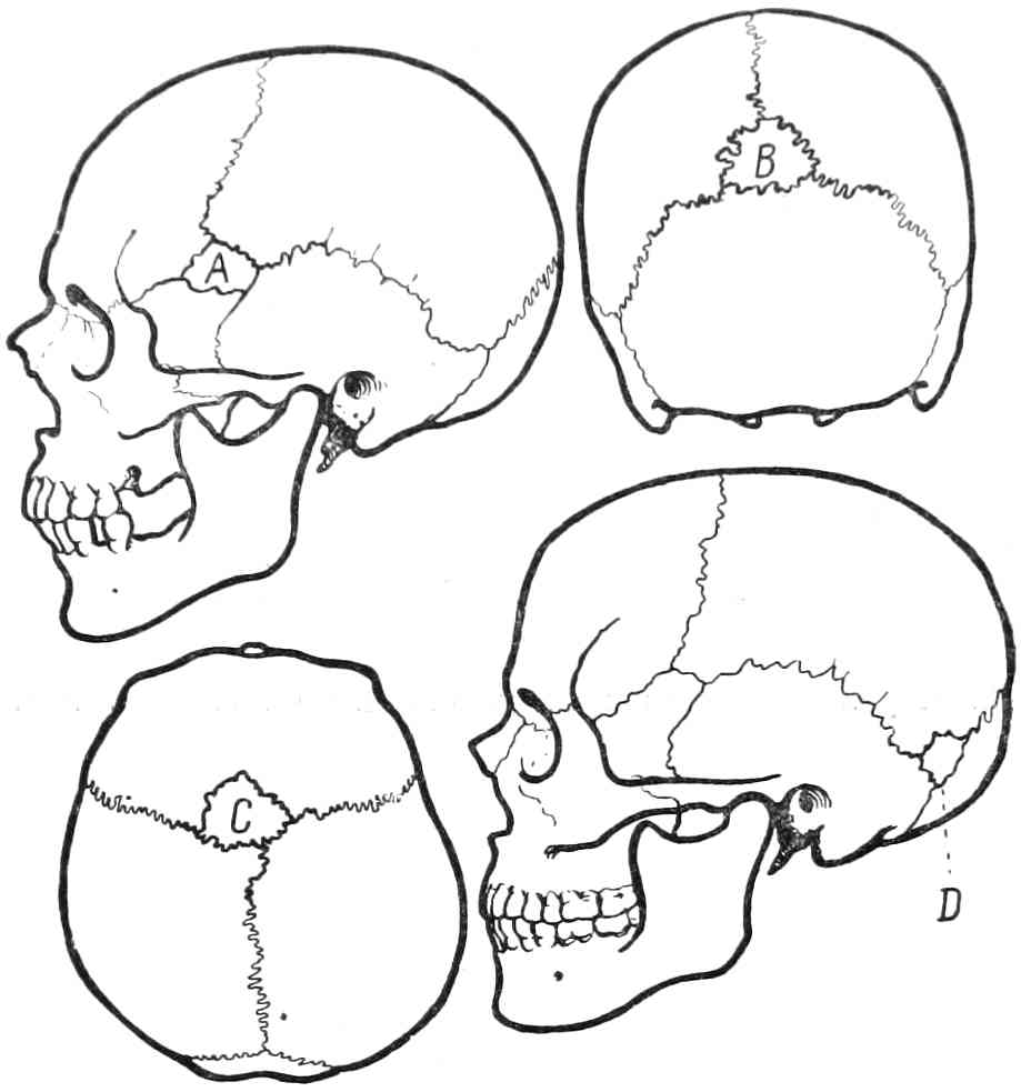 Рис. 345. Родничковые кости в черепе человека.
