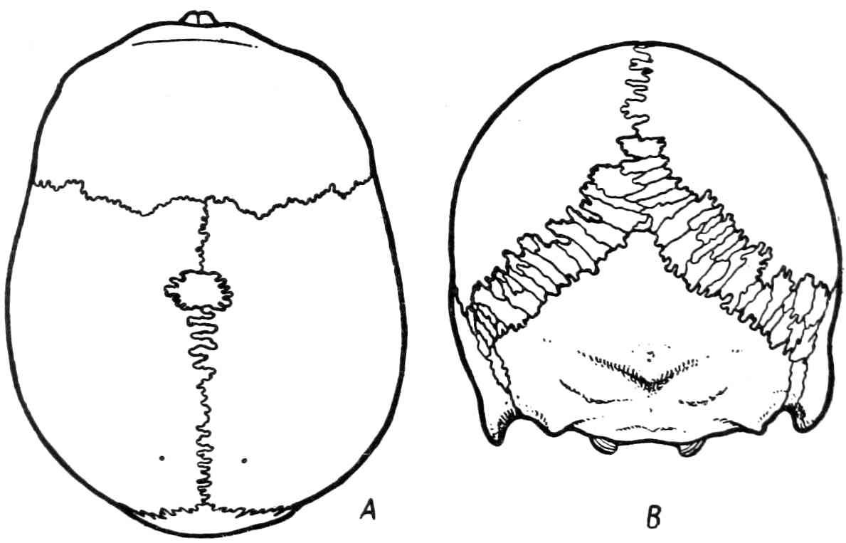 Рис. 347. Шовные кости (ossa suturarum).