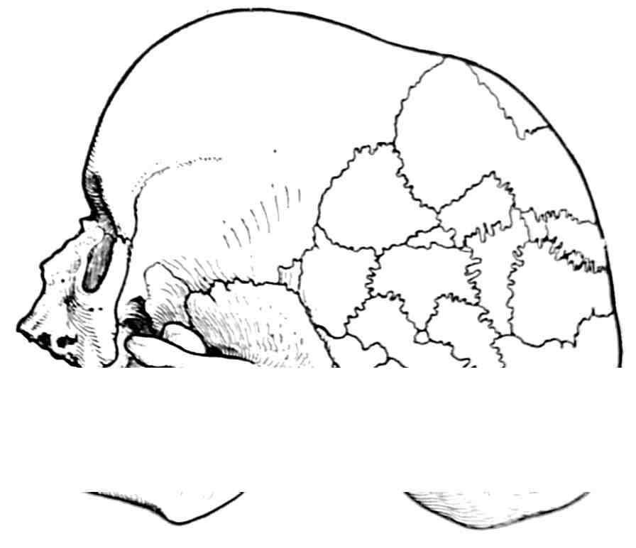 Рис. 350. Случай dysostosis cleidocranialis. Череп 59-летнего мужчины (Хульткранц, 1908).